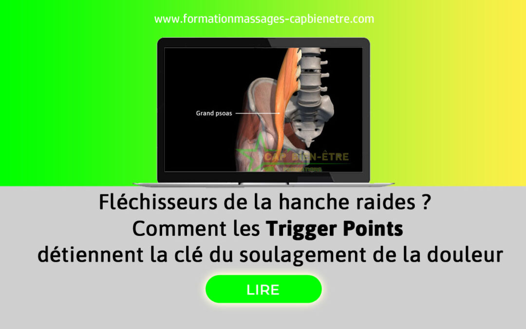 Fléchisseurs de la hanche raides ? Comment les Trigger Points détiennent la clé du soulagement de la douleur